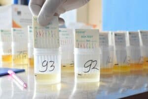 Deteksi Dini, Skrining Tes Urine KPPBC TMC Malang Dalam Rangka P4GN
